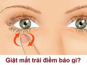Giật mắt điềm gì ở nam và nữ, hên hay xui