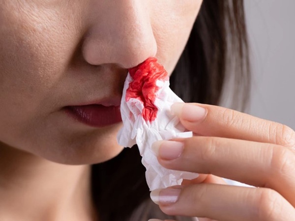 Nằm mơ thấy chảy máu mũi có phải điềm hung không?